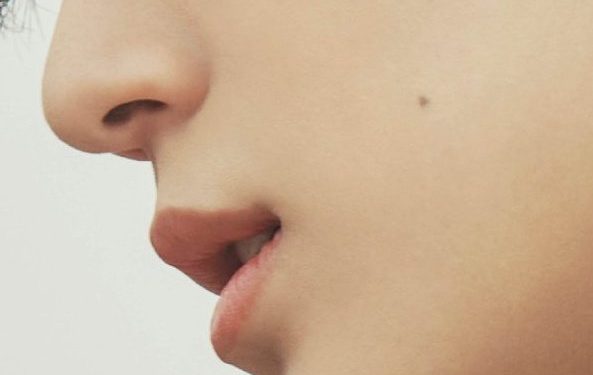 mole cheek