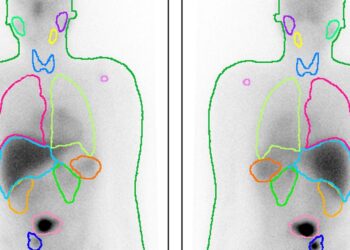 tata 1AFZ3 e1751069574727